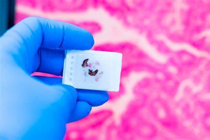 Erreurs courantes de lecture vidéo : chargement et mise en mémoire tampon