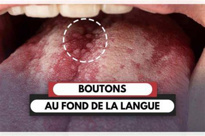 Filtres et facettes pour affiner la recherche de films et s&eacute;ries